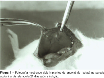 Endometriosis: experimental model in rats
