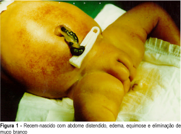 Meconium peritonitis in the differential diagnosis of fetal ascites: a case report