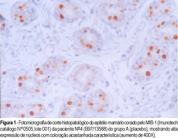 Evaluation of Proliferative Activity in the Mammary Epithelium Adjacent to Fibroadenoma in Women Treated with Tamoxifen