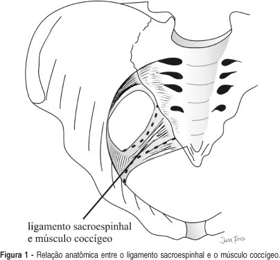 Sacrospinous colpopexy: analysis of its use in patients with uterovaginal and vaginal vault prolapse after histerectomy