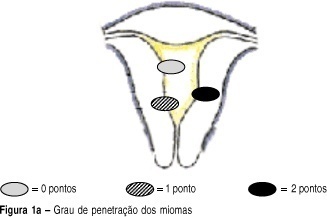 Submucous fibroids: presurgical classification to evaluate the viability of hysteroscopic surgical treatment