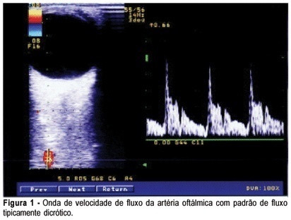 Dopplervelocimetry of ophthalmic and central retinal arteries in normal pregnancies