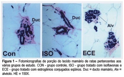 Morphological and molecular effects of isoflavone and estrogens on the rat mammary gland
