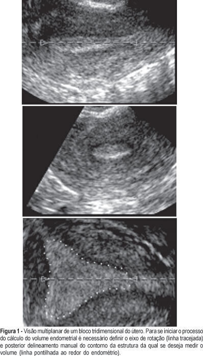 The reproducibility of VOCAL endometrial volume measurement: importance of the step rotation