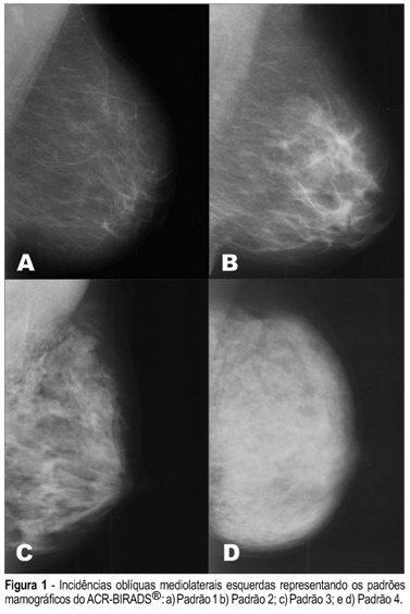 Association between HaeIII and MspI polymorphisms of estrogen receptor alpha gene and mammographic density in post-menopausal women