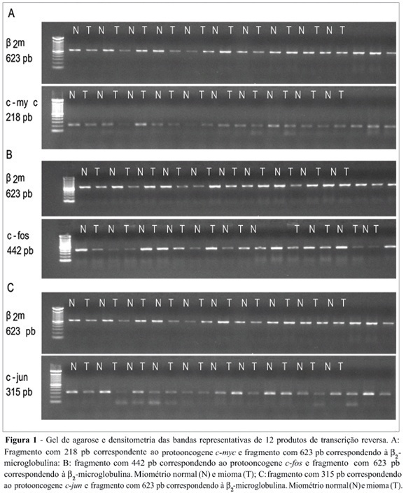 Expression of the protooncogenes c-fos, c-myc and c-jun in human normal miometrium and leiomyoma