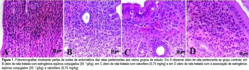 Effects of combined estrogen and raloxifene therapy on rat endometrium