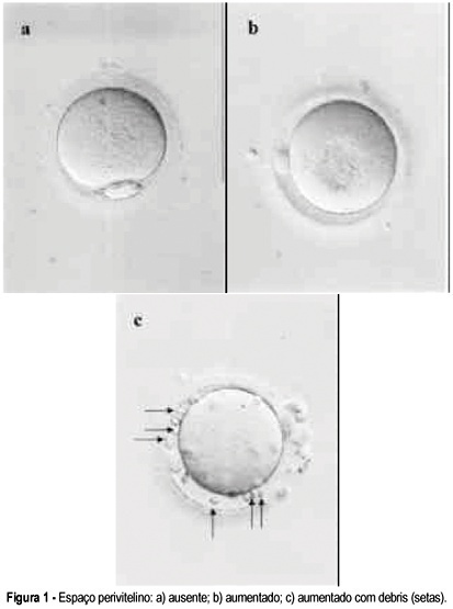 Relationship between oocyte morphology and fertilization rate after ICSI