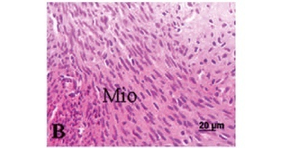 Effects of isoflavones on the adult rat myometrium