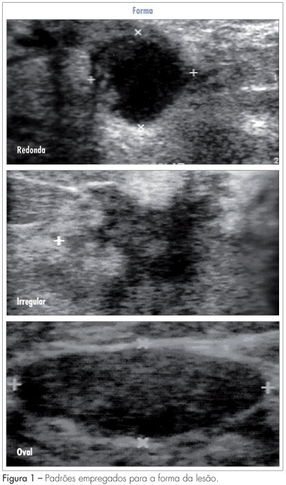 What characteristics proposed by BIRADS ultrasound better distinguish between benign and malignant nodes?