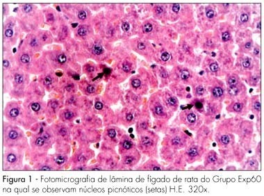 Morphological analysis of liver and kidneys of pregnant rats and their fetuses upon chronic Ritonavir administration