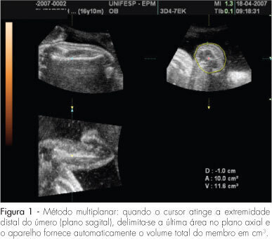 Prediction of birth weight by three-dimensional ultrasonography using fetal upper arm volume: preliminary results
