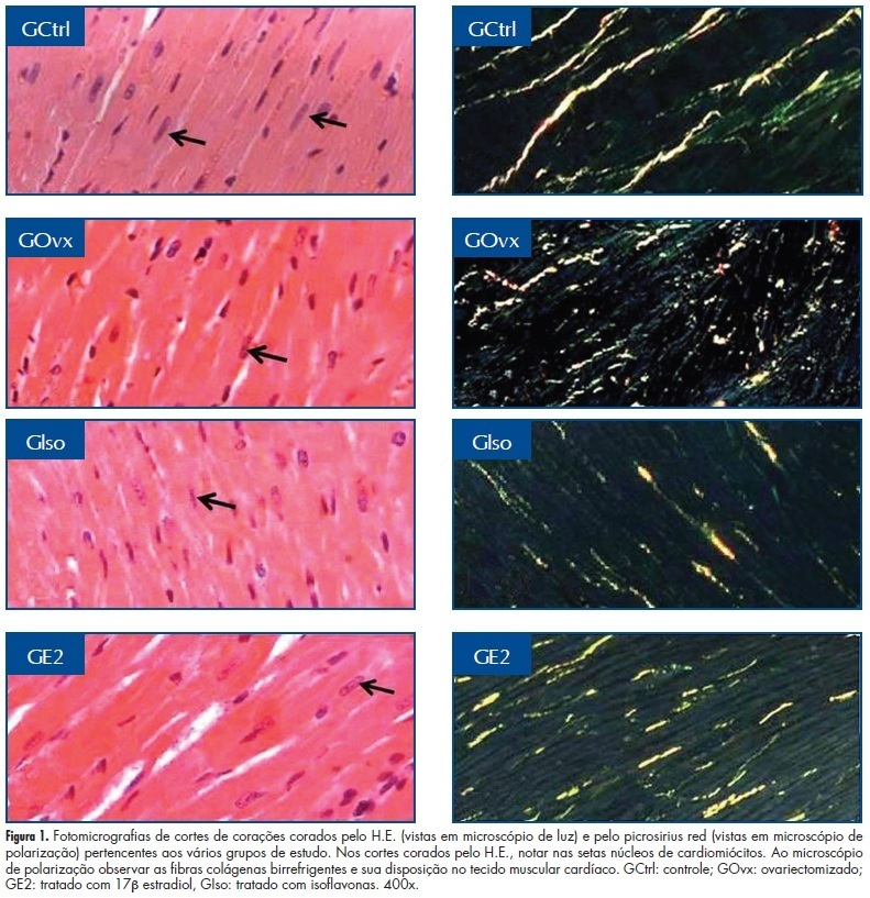 Cardiomyocytes morphology and collagen quantification in the myocardium of female rats treated with isoflavones or estrogens