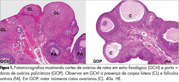 Morphology of the interstitial cells of rat polycystic ovaries: an experimental study
