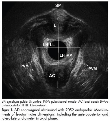 Anatomical and functional characteristics of the pelvic floor in nulliparous women submitted to three-dimensional endovaginal ultrasonography: case control study and evaluation of interobserver agreement
