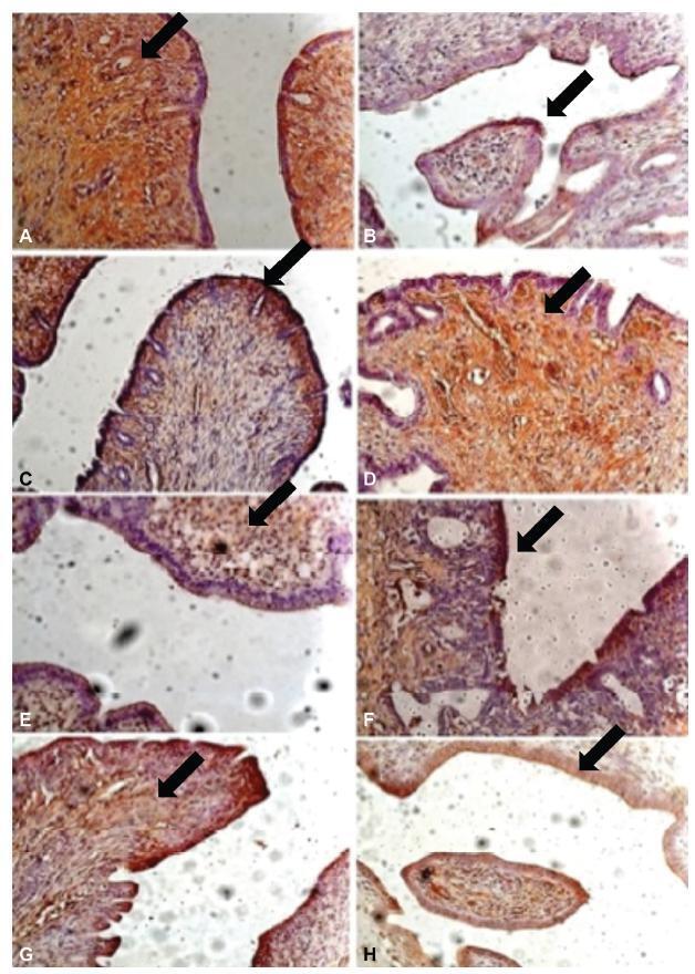 Increased Expression Levels of Metalloprotease, Tissue Inhibitor of Metalloprotease, Metallothionein, and p63 in Ectopic Endometrium: An Animal Experimental Study
