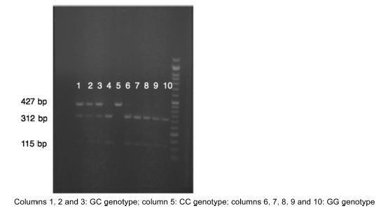 Association between col1a2 Polymorphism and the Occurrence of Pelvic Organ Prolapse in Brazilian Women
