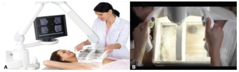 Comparison of Automated Breast Ultrasound and Hand-Held Breast Ultrasound in the Screening of Dense Breasts