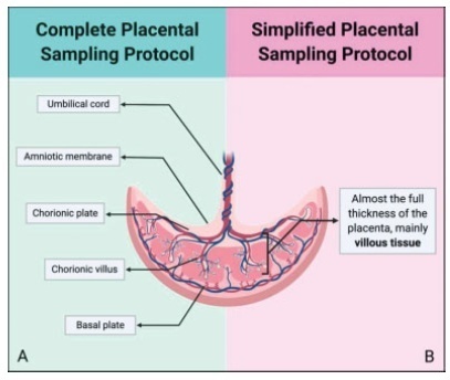 Placental Sampling for Understanding Viral Infections – A Simplified Protocol for the COVID-19 Pandemic