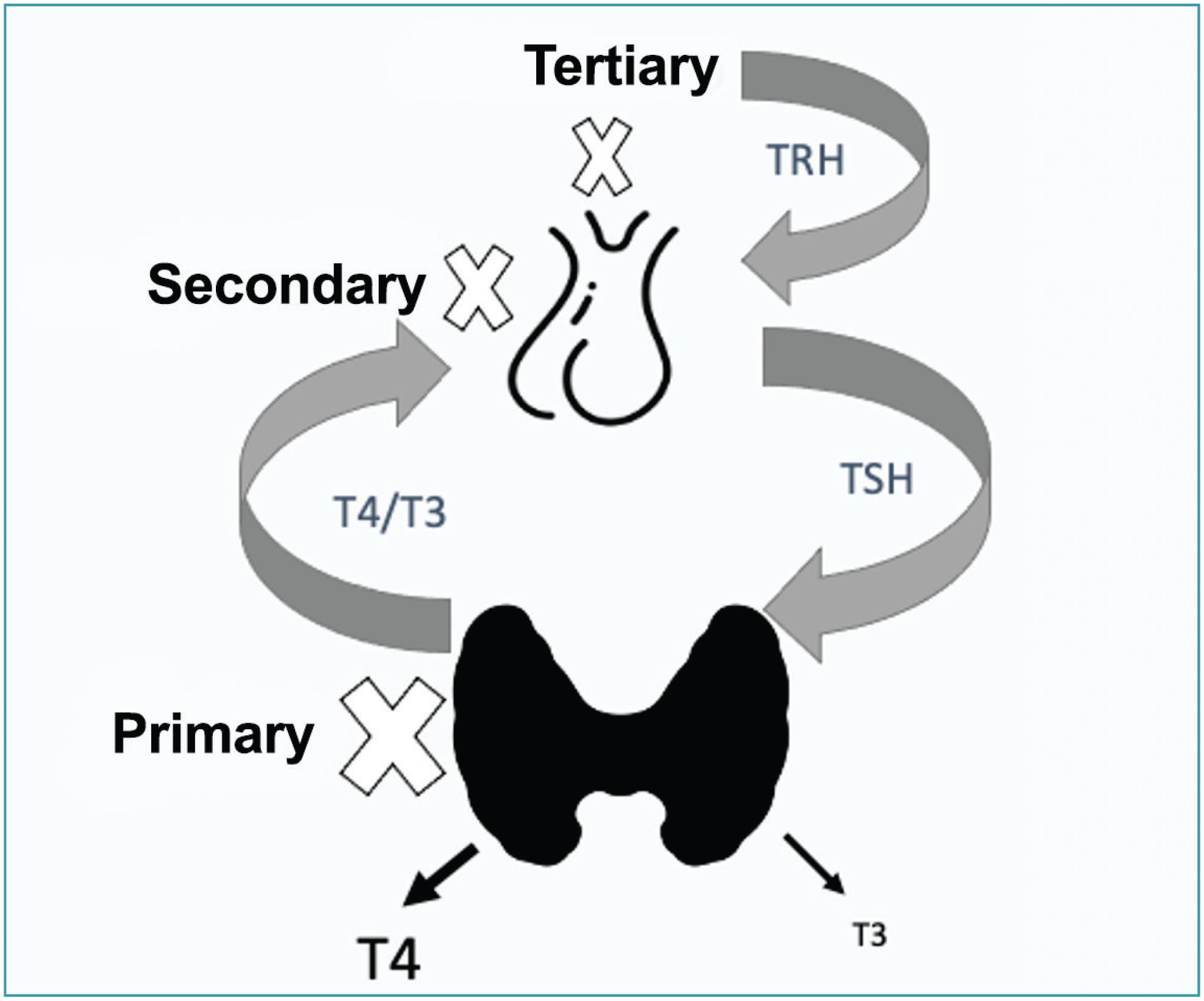 Screening, diagnosis and management of hyperthyroidism in pregnancy: Number 8 – Agosto 2022