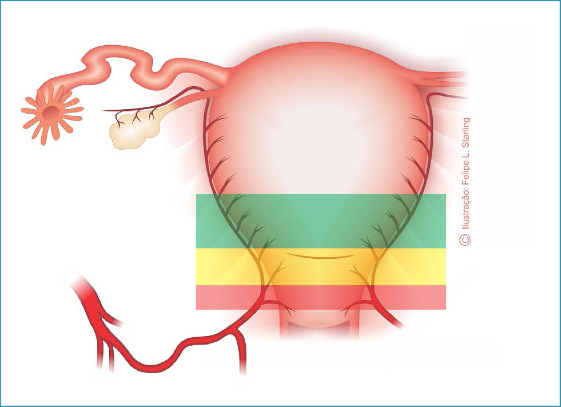 Difficult fetal extraction in cesarean section: Number 8 – 2024