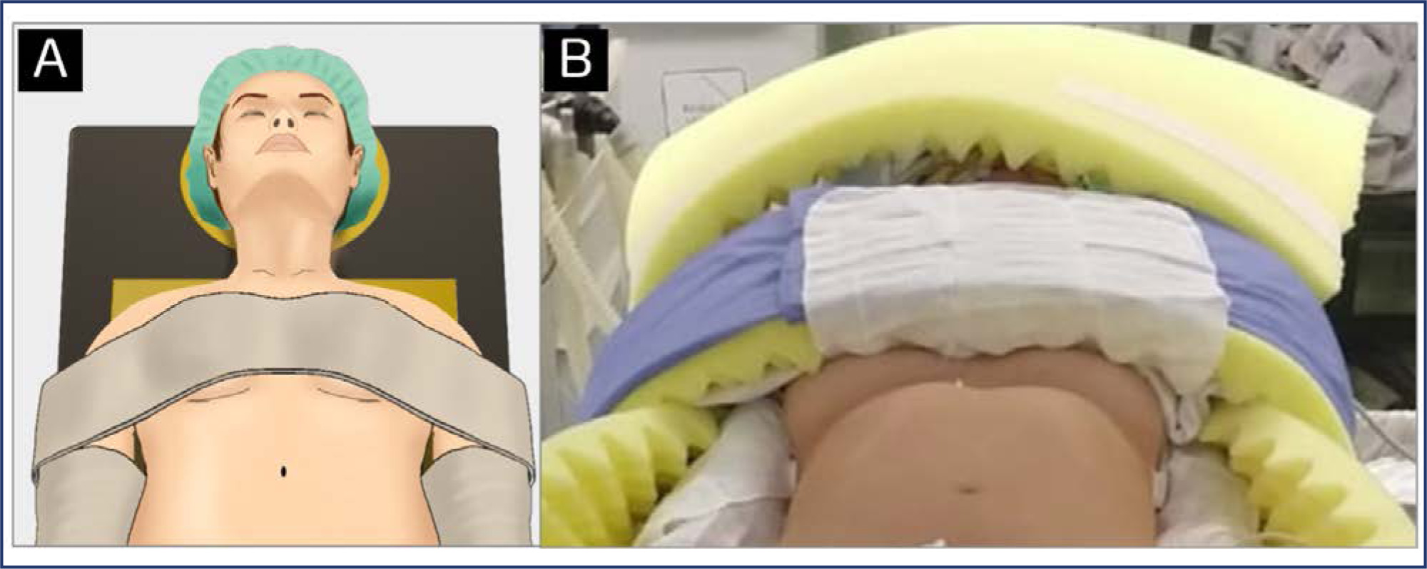 Patient positioning in minimally invasive gynecologic surgery: strategies to prevent injuries and improve outcomes
