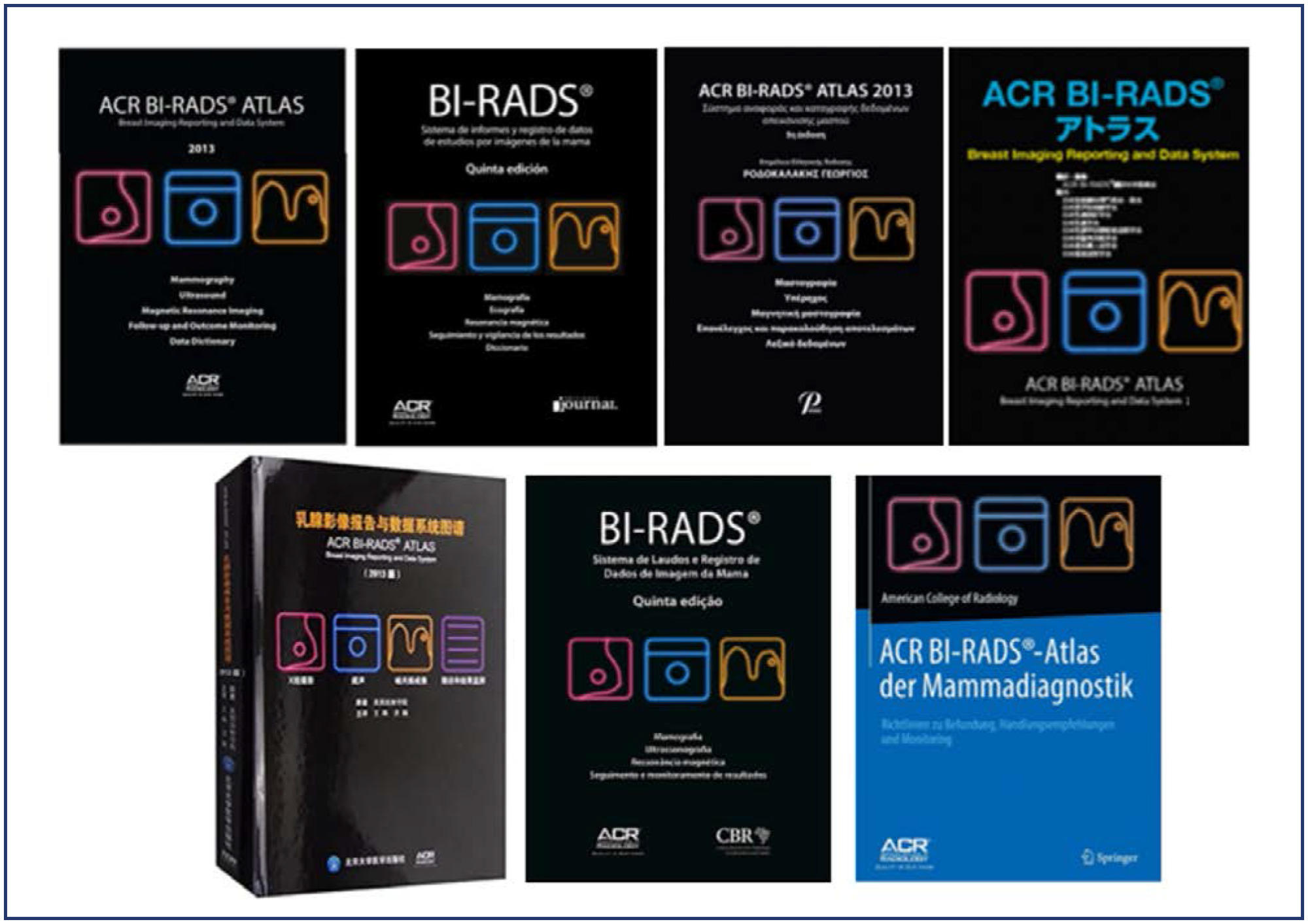 Breast Imaging Reporting and Data System (BI-RADS®): a success history and particularities of its use in Brazil